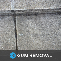 Gum Removal